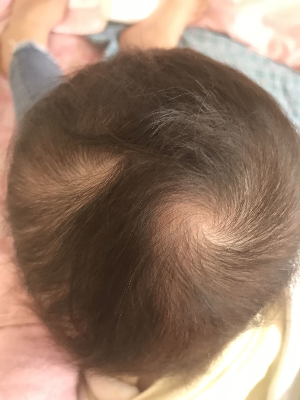 宝宝头上长两个旋好不好？眉毛上方也有一个？
