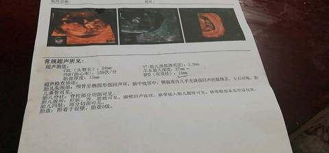 journal_insert_pic_1213251463