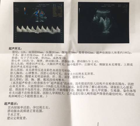 journal_insert_pic_1213549480