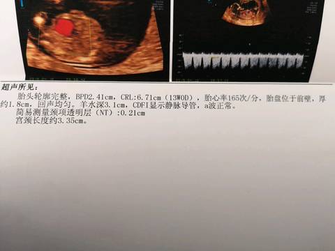 journal_insert_pic_1213895919