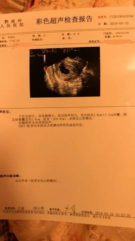 journal_insert_pic_1214243146