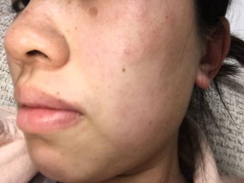 journal_insert_pic_1214824485