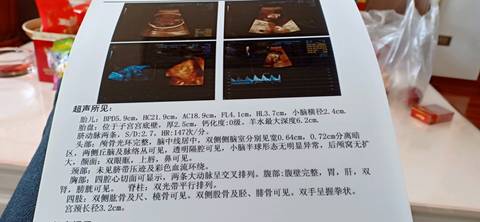 journal_insert_pic_1214460339