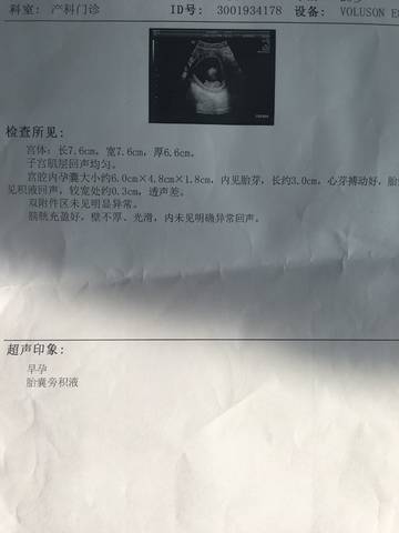 journal_insert_pic_1215061065