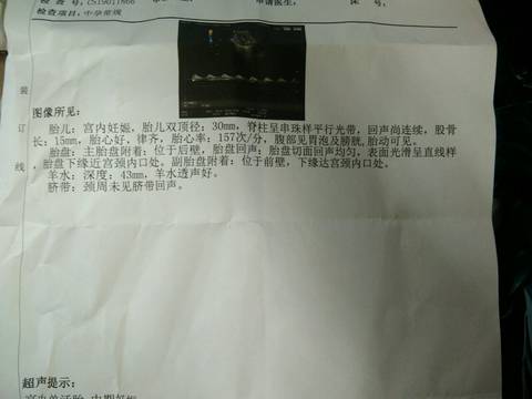 journal_insert_pic_1215660510