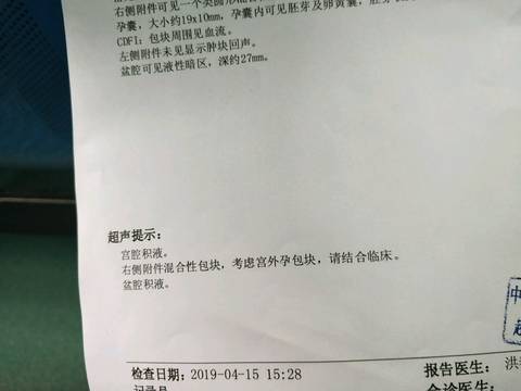 journal_insert_pic_1217255502