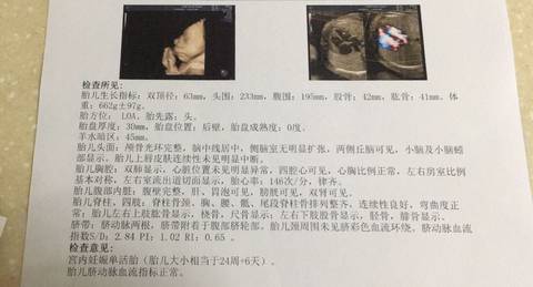 journal_insert_pic_1217021601