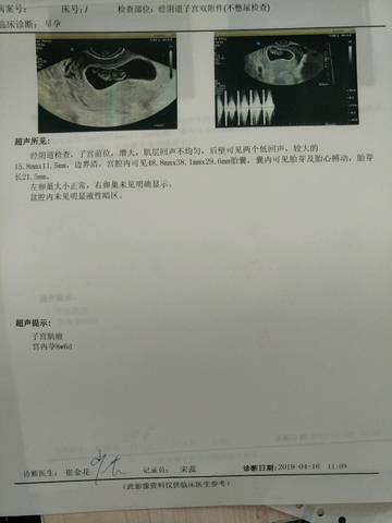 journal_insert_pic_1217657249