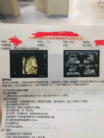 journal_insert_pic_1218054601