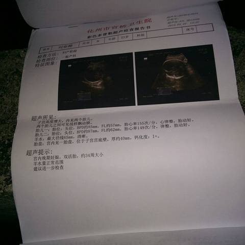 journal_insert_pic_1218120087