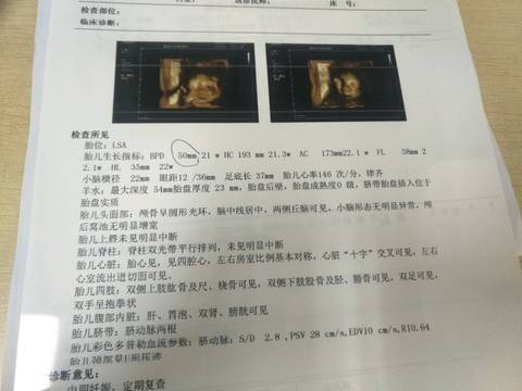journal_insert_pic_1218280798