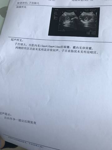 journal_insert_pic_1218861064