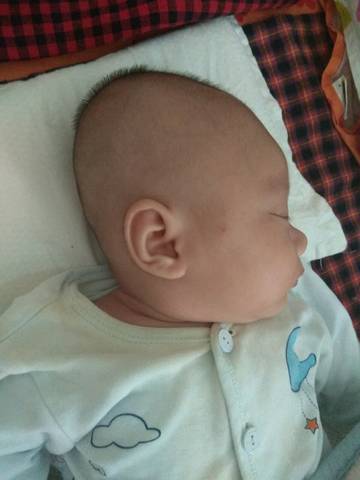 急 两个月宝宝头型变得又长又尖 宝宝树