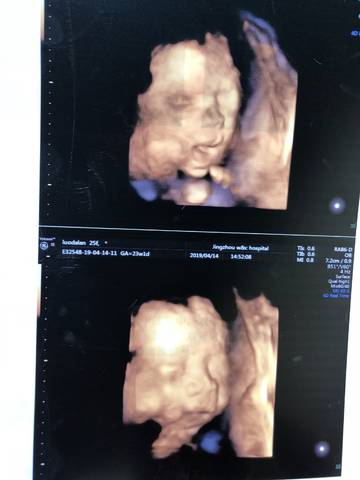 journal_insert_pic_1223117703