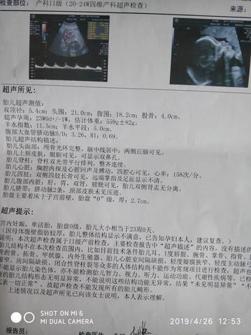 journal_insert_pic_1223911378