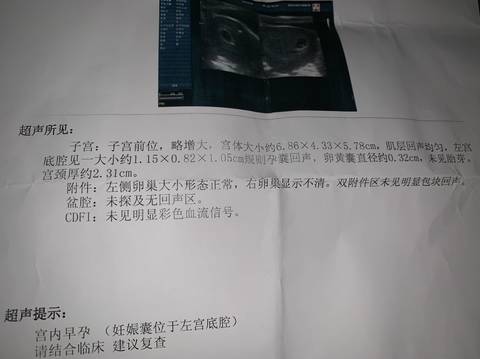journal_insert_pic_1224544953