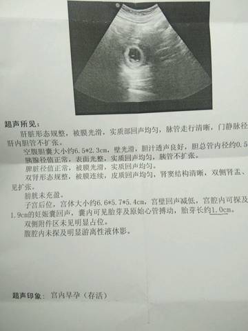 journal_insert_pic_1224506346