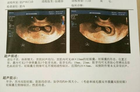 journal_insert_pic_1225202804
