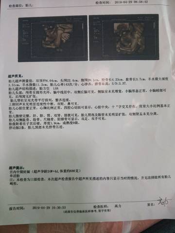 journal_insert_pic_1225962588