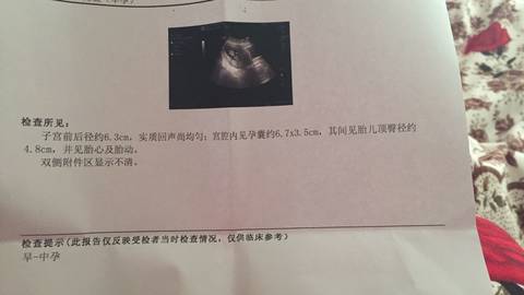 journal_insert_pic_1225814598