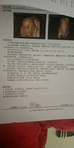 journal_insert_pic_1230289446
