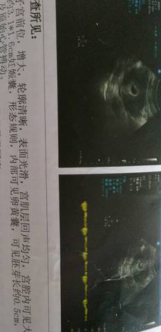 journal_insert_pic_1230954603