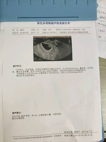 journal_insert_pic_1231123798
