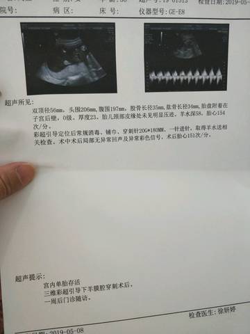 journal_insert_pic_1231831709