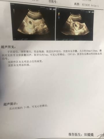 journal_insert_pic_1232495418