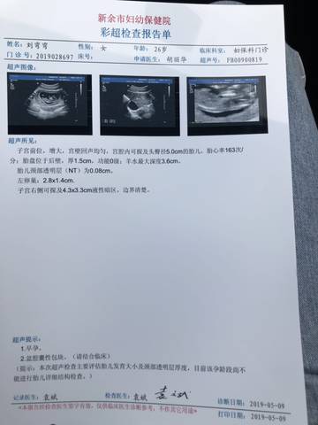 journal_insert_pic_1232443003