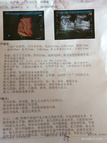 journal_insert_pic_1232977397