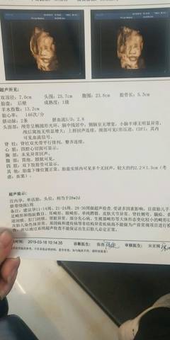 journal_insert_pic_1232769290