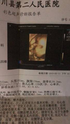 journal_insert_pic_1234605452