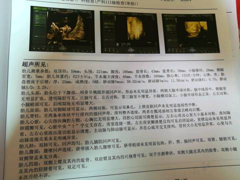 journal_insert_pic_1234796745