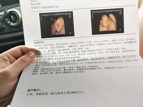 journal_insert_pic_1235574555