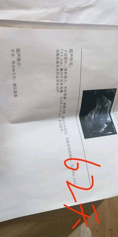 journal_insert_pic_1235713889