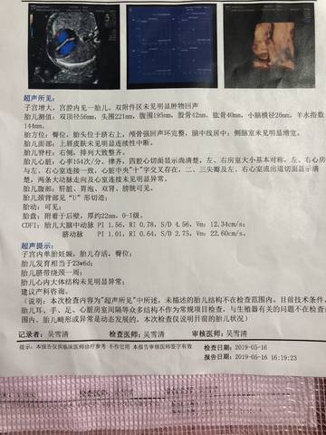 journal_insert_pic_1236958417