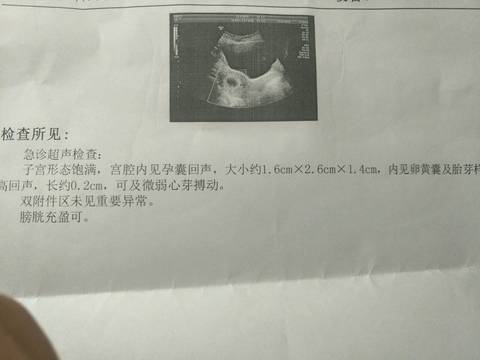 journal_insert_pic_1237237140