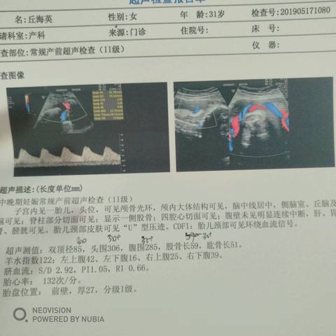 journal_insert_pic_1237189539