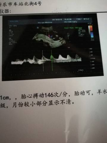 journal_insert_pic_1238026723