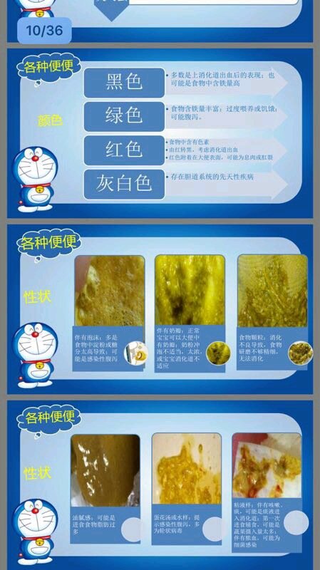 关于宝宝大便的问题