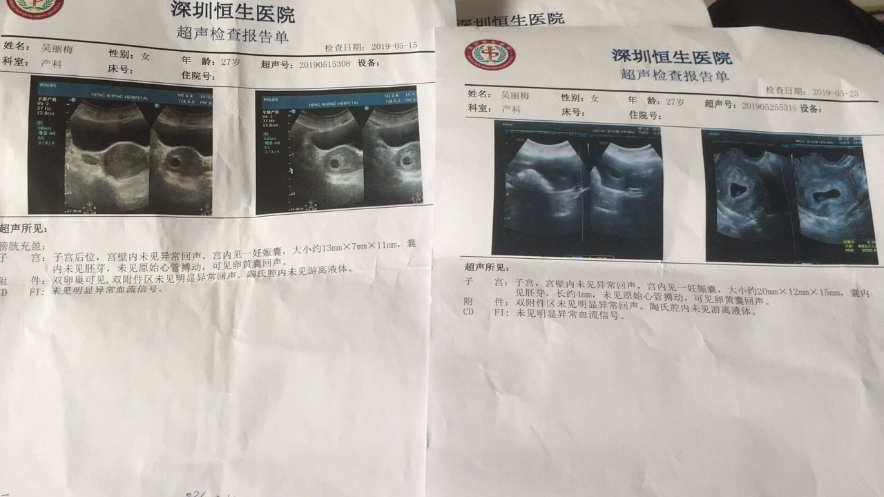 还是没有胎心！😨😨😨
