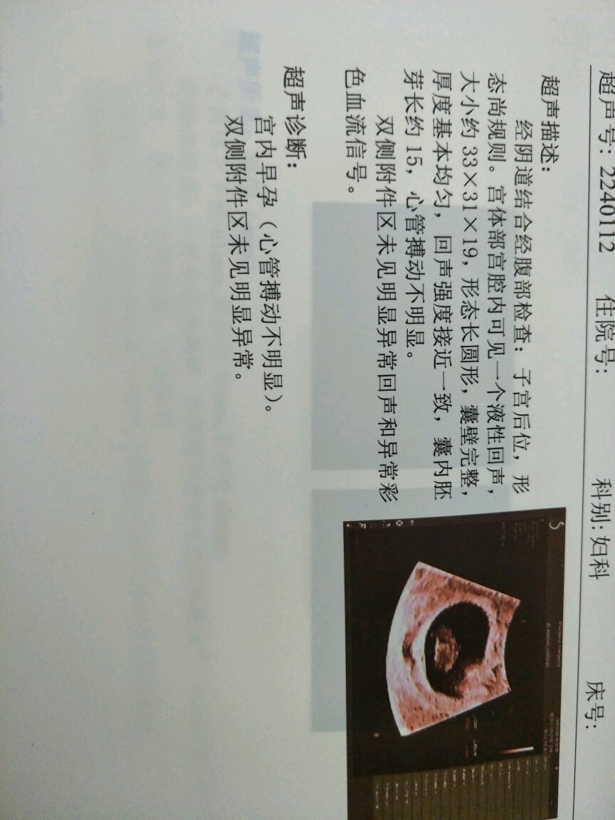 心管波动不明显