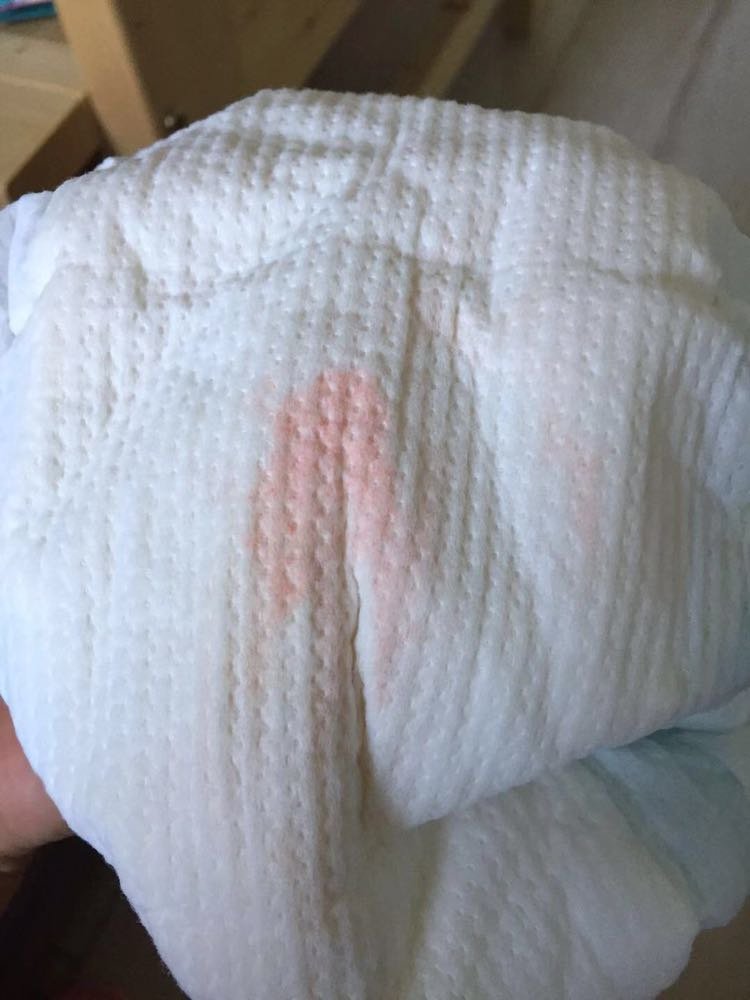 六个月女宝宝尿不湿有橘红色的东西，怎么回事啊