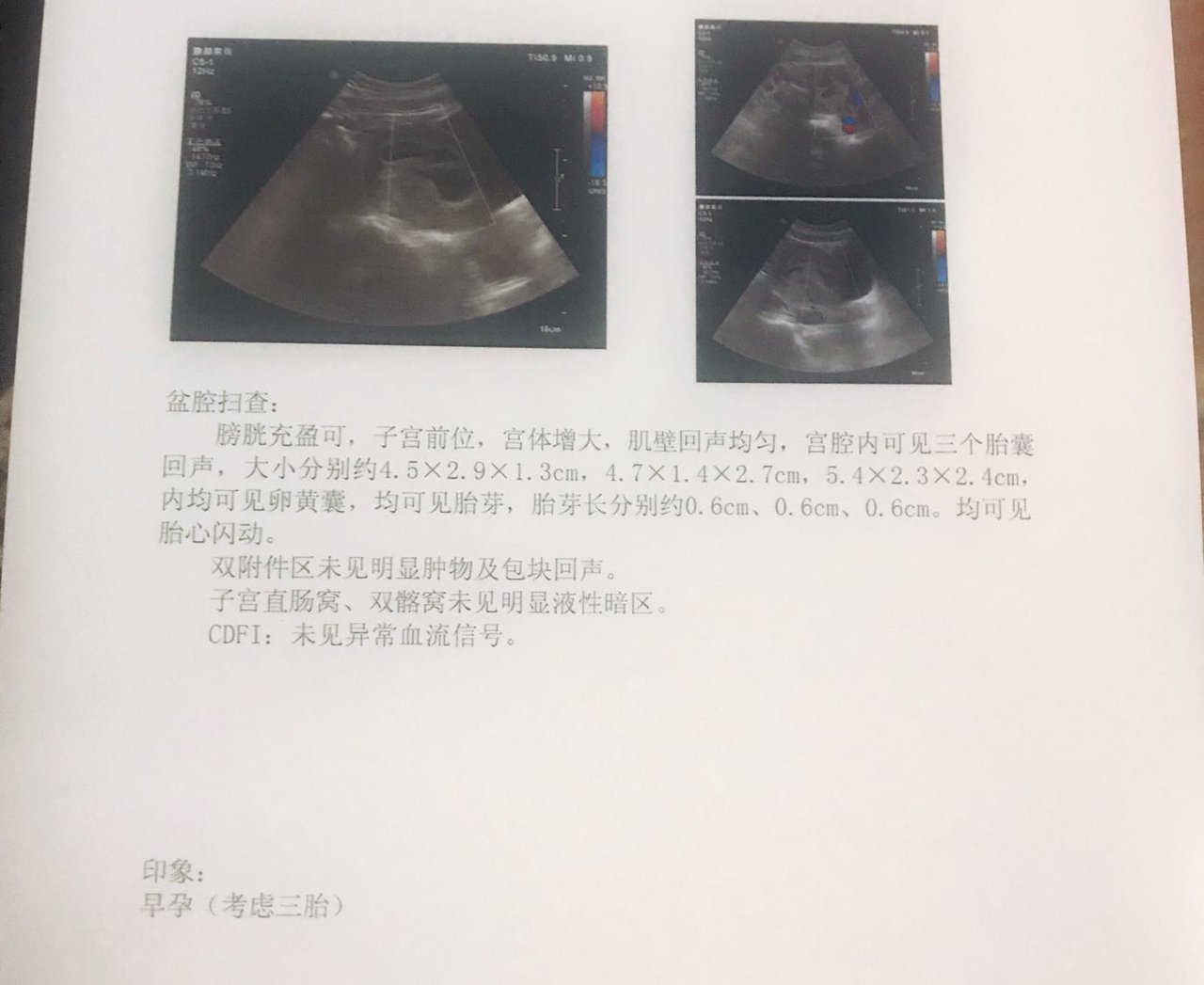 预产期2020年3月15的金鼠