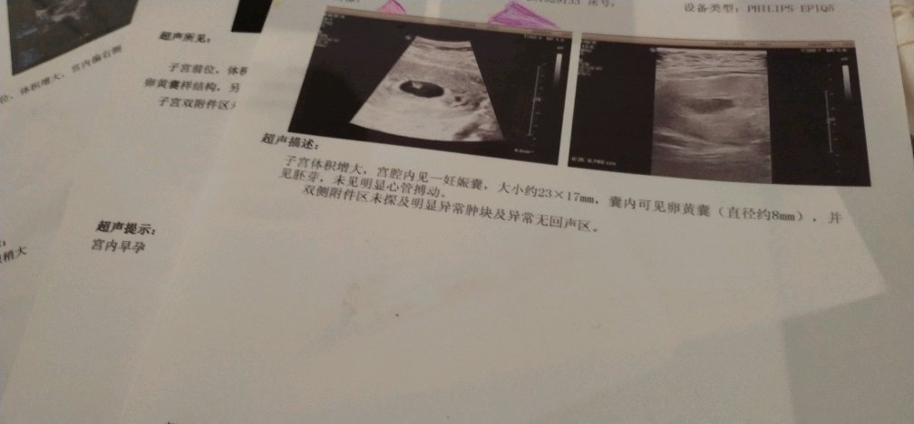 【新手报到】医生说有可能停孕的可能，帮帮看看