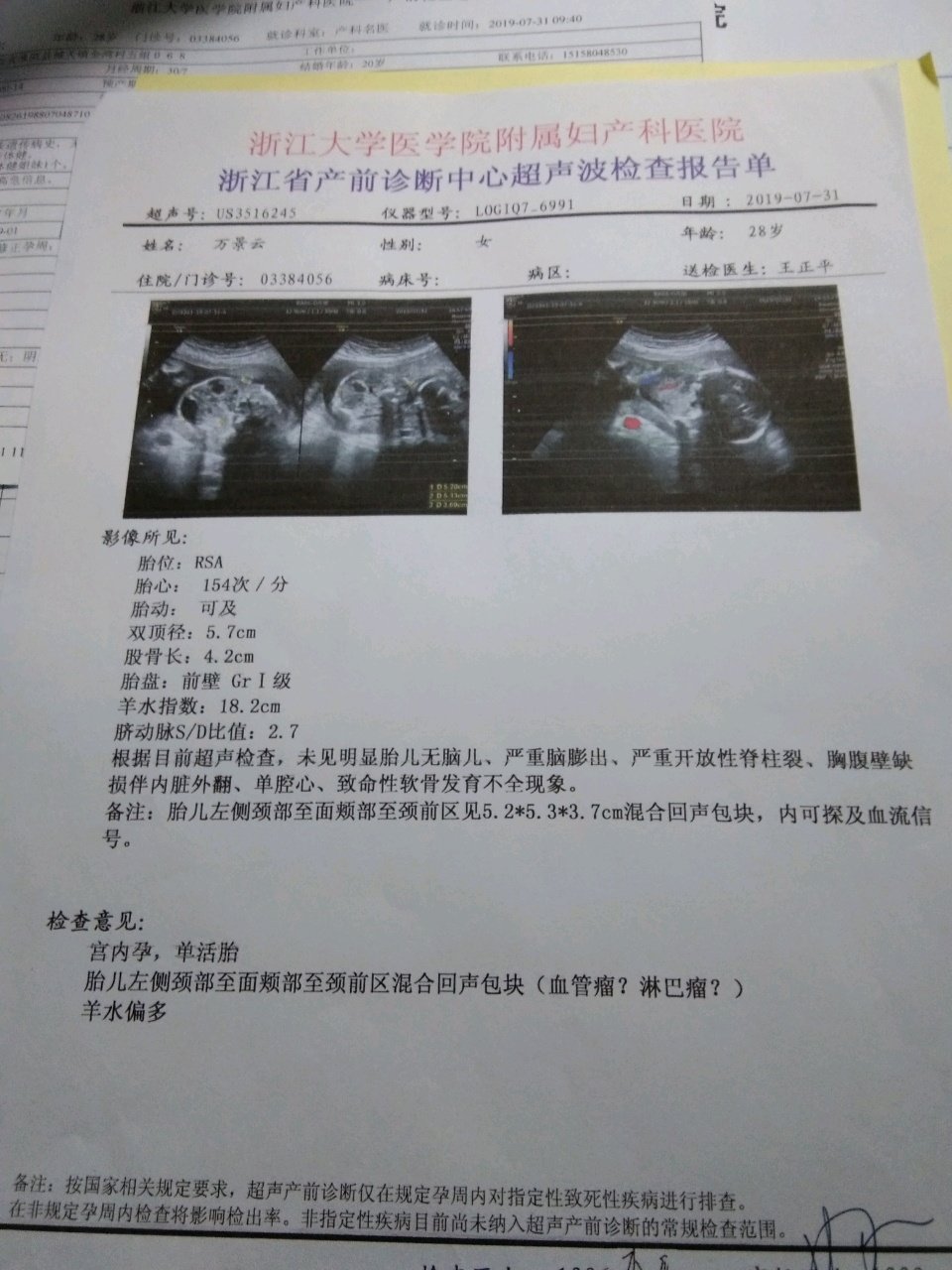 胎儿血管瘤淋巴瘤真的很担心。