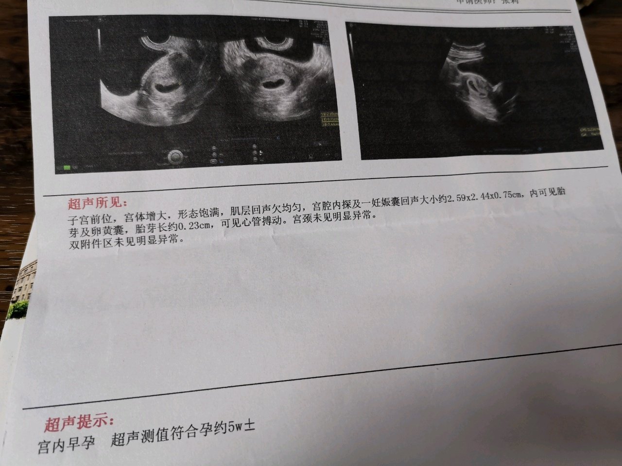 帮我看看啥意思，孩子咋样啊。