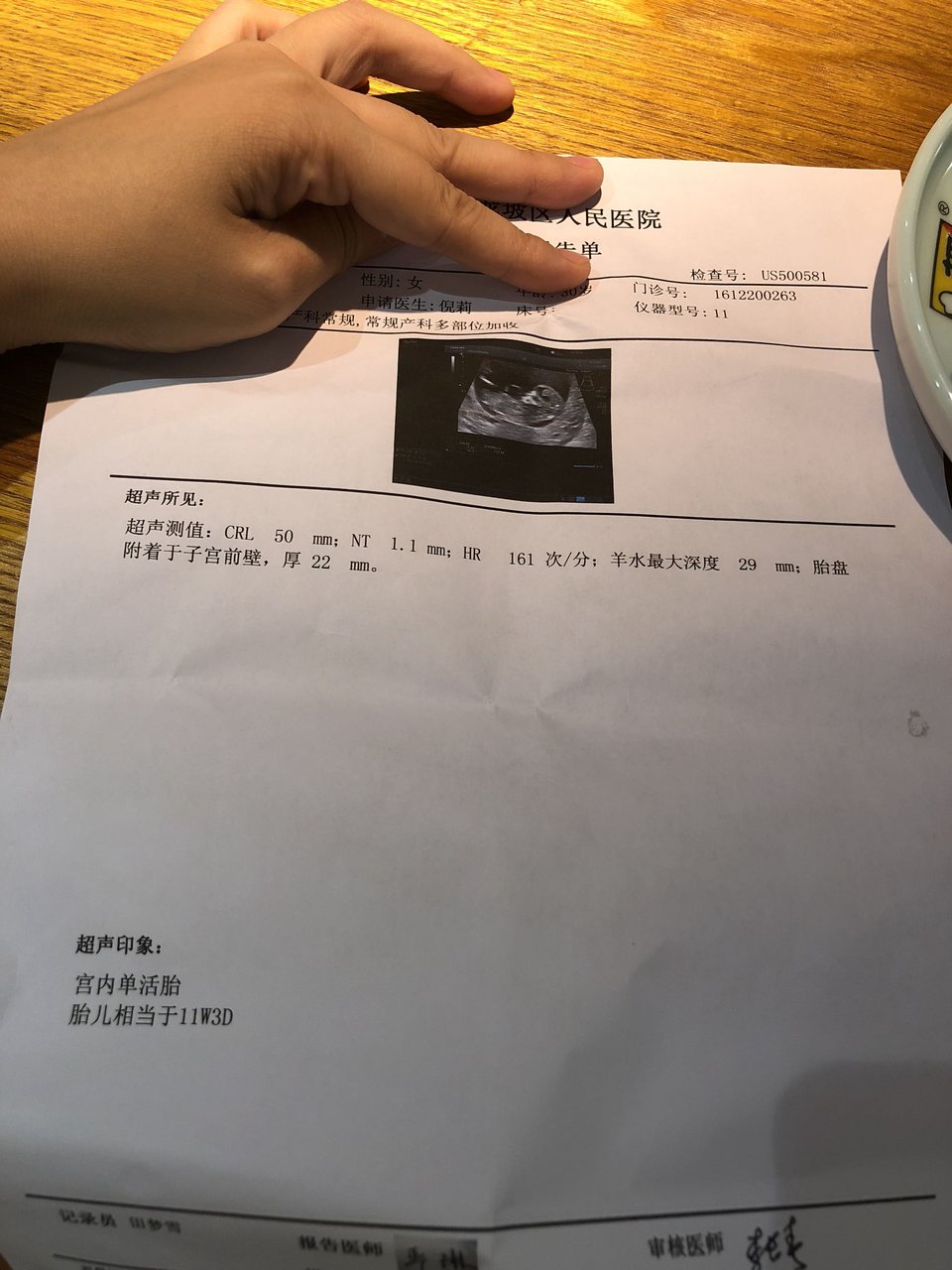 新鲜出炉的NT…