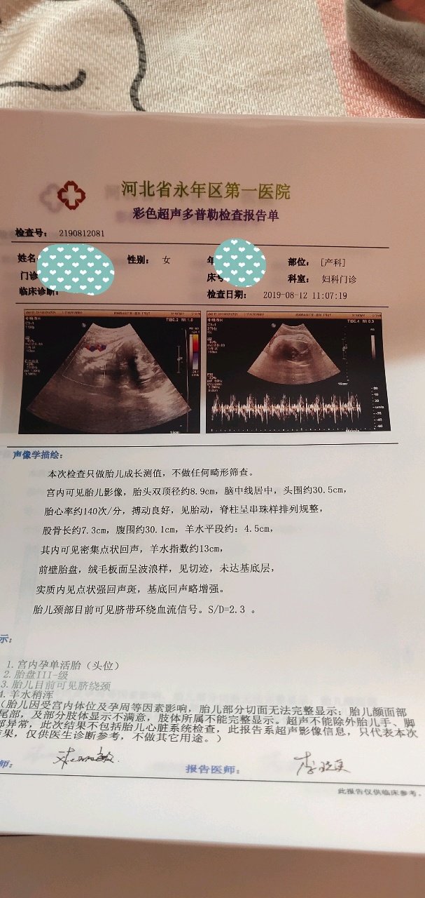 孩子什么时候出来呀